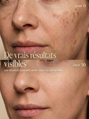 Masque LED Visage Corivy – Anti-Âge & Éclat de la Peau